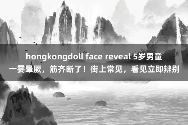 hongkongdoll face reveal 5岁男童一霎晕厥，筋齐断了！街上常见，看见立即辨别